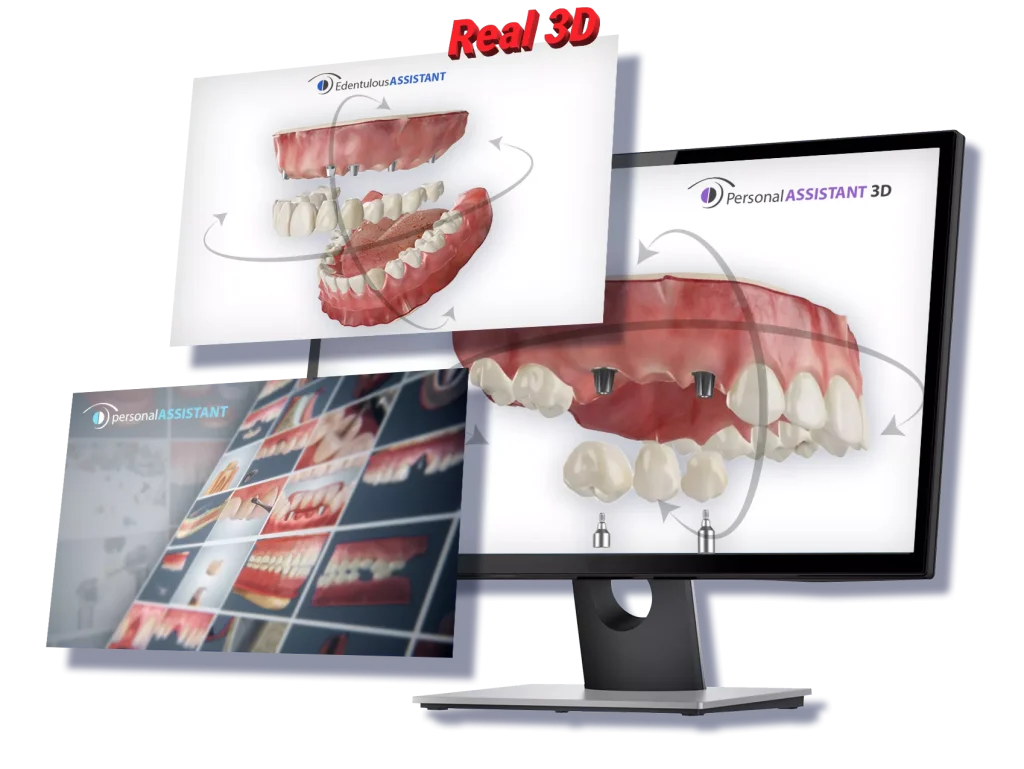 DentalMaster 3D products on screens