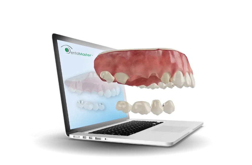 3d dental model on laptop
